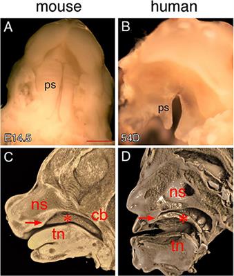 Differences in Oral Structure and Tissue Interactions during Mouse vs. Human Palatogenesis: Implications for the Translation of Findings from Mice